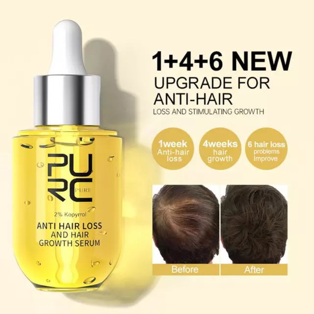 Productos para el crecimiento del cabello Ginger Essence aceite de regeneración rápida tratamiento antipérdida;
