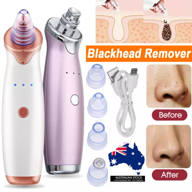 Face Facial Pore Blackhead Remover Vacuum Derma Suction Diamond Dermabrasion MN