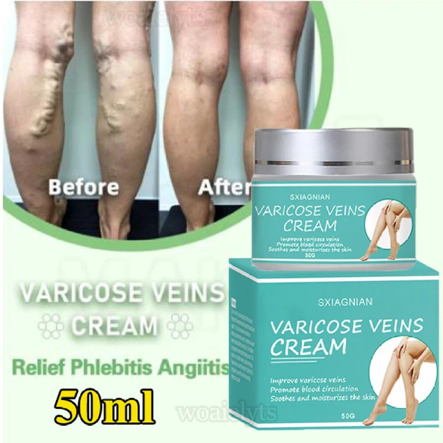 Crème Traitement Varices Et Phlébite - Neuf Générique