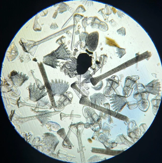 J.D. Moller Microscope Slide Sea Urchin Calcareous Pedicellaria of Echinus