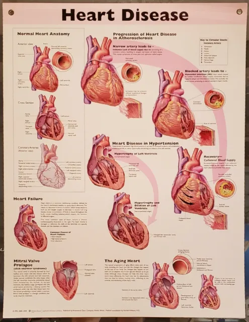 Anatomical Charts, Cardiac, Respiratory, etc. Diseases and Disorder- Lot of 12 2