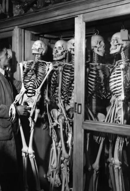 Antique Medical Skeletons Photo 1196b Oddleys Strange & Bizarre