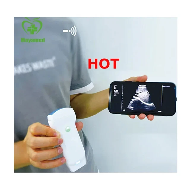 portable ultrasound scanner doppler micro convex usb wifi wireless probe ultraso