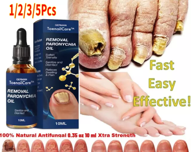 Anti Fungal Treatment Extra Strength Toenail Fungus Fungi Xs Nail Athlete's Foot