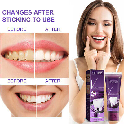 Blanqueamiento dental higiene oral dientes cepillado eliminación de manchas blanqueador pasta de dientes Q