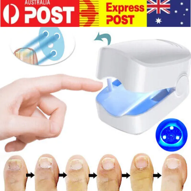 Nail Fungus Laser Device Light Therapy Onychomycosis Toes Treatment 910nm Home