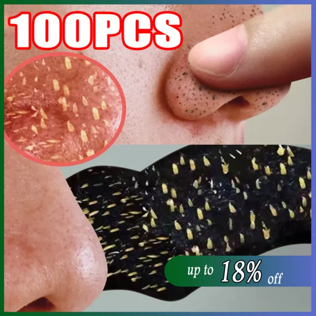 ✅100PCS Nose Pore Strips Blackhead Removal Unclog Pores Smooth Deep Cleansing✅