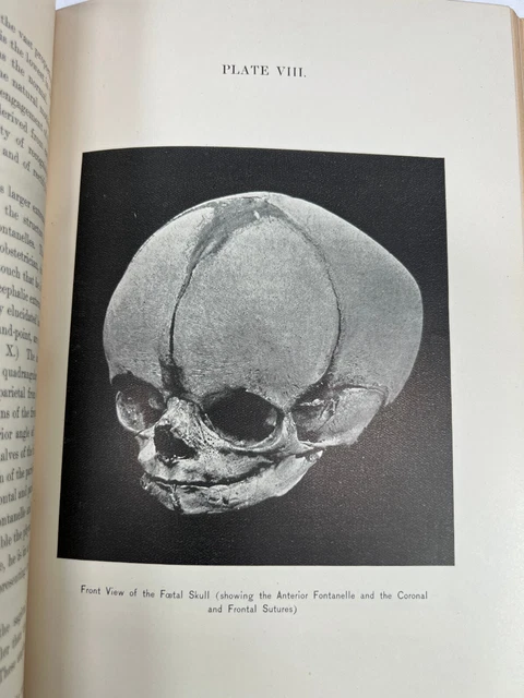 1900 Practical Obstetrics Sex Female Birth Grandin antique medical book oddity