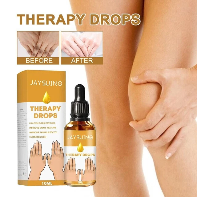 Aceite corrector de manchas oscuras corrector de aceite para la piel acantosis nigricans gotas