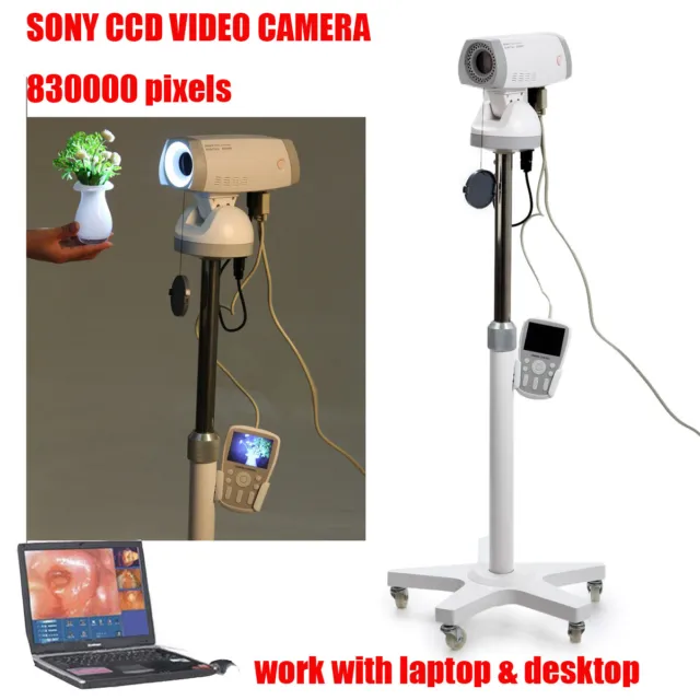 New Digital Video Electronic Colposcope Camera 830,000 pixels With Tripod