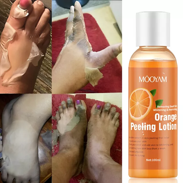 NEW Orange Peeling Lotion Body Whitening Black Skin Lightening Brightening Scrub