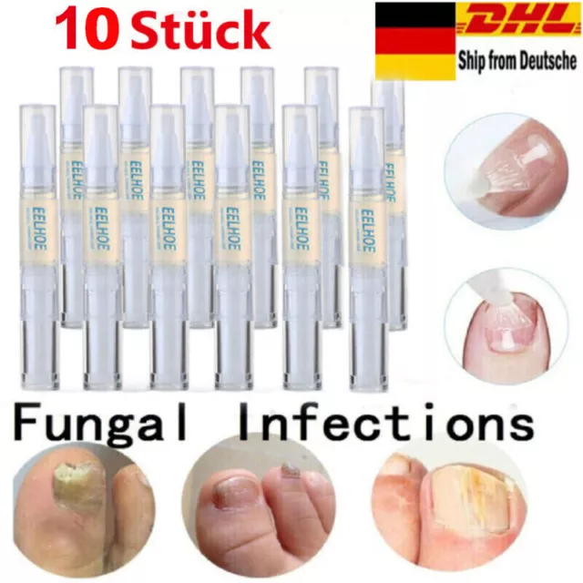 10 Stück Anti Nagelpilz Stift Nagelpilz Behandlung Nagelpflege Nagelreparatur