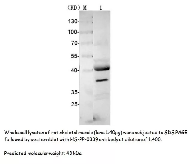 Rabbit anti-Human MAPK3 Polyclonal Antibody, 100uL, www.sunnybiotechnology.com