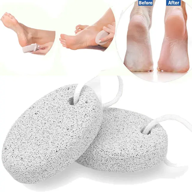 Pumice Stone for Feet 2 PCS Set_Foot Care Natural Pummice Stones for Dead Hard