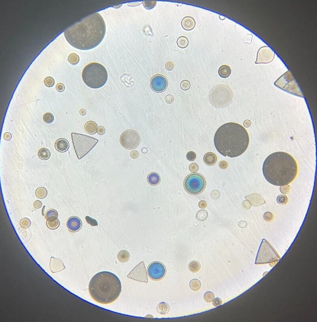 J.D. Moller Microscope Slide Diatom Cuxhaven Germany Dark Ore Gold Medal 1869