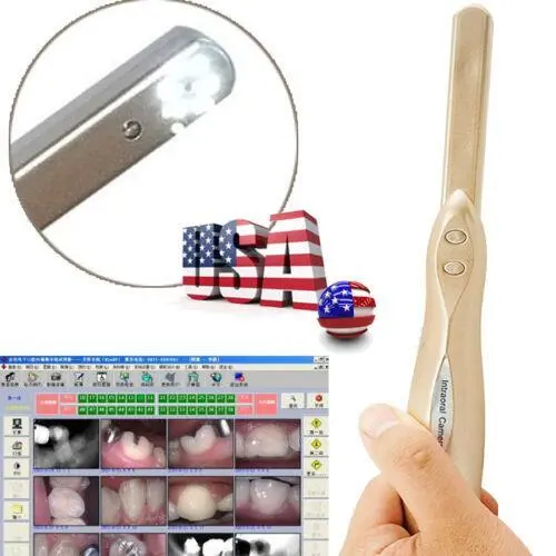 6-LED Intra Oral USB 2.0 Dentist Dynamic HD Image Dental Intraoral Camera