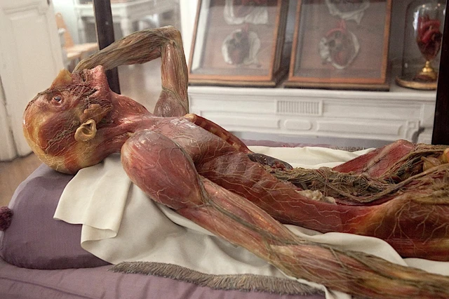 Antique Medical Anatomical Doll Photo 402b Odd Strange & Bizarre