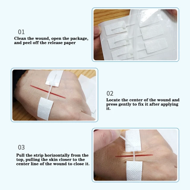 Closure Patch BAND-AID ZIPPER TIE Wound Closure Patch Hemostatic Patch Wound Zipper ...