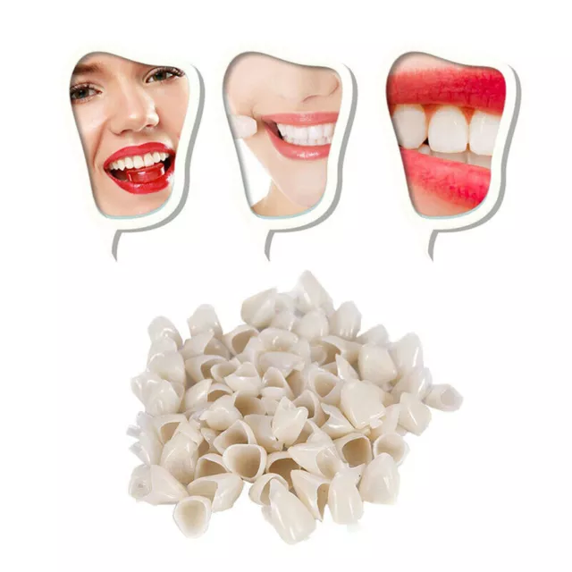 Temporary Crowns Posteriors Anterior Molar Resin Tooth Teeth Caps Dental UK 3