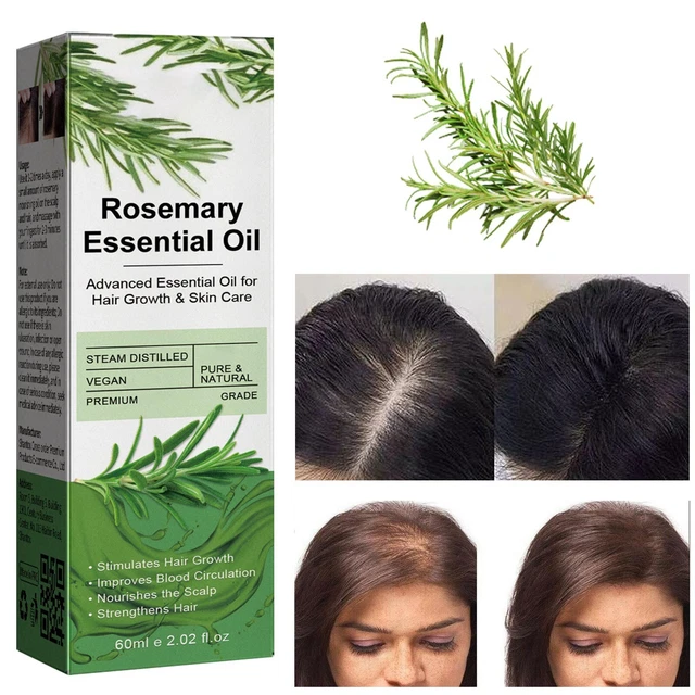 Aceites orgánicos para el crecimiento del cabello y cuidado de la piel aceite natural para la pérdida del cabello