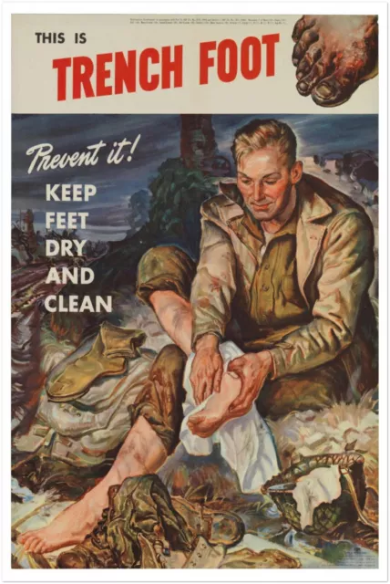 Trench Foot - World War 1 Poster - WW1 Vintage Poster