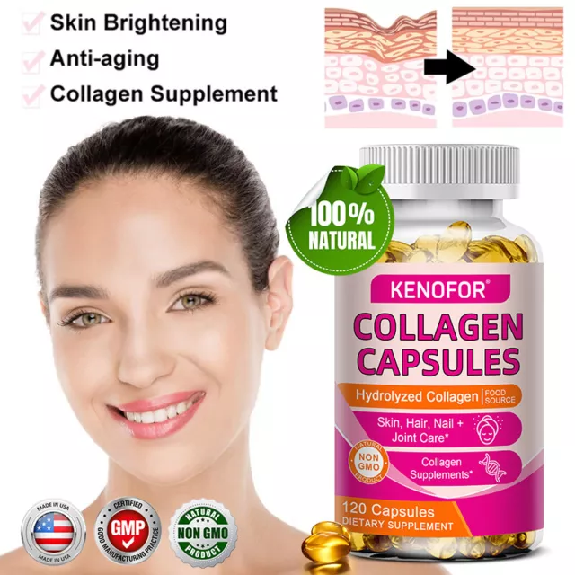 Hydrolysed Collagen 400mg Capsules Type 1 - Hair Skin Anti Ageing Joints Bones