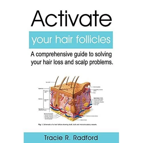 ACTIVATE YOUR HAIR Follicles: A Comprehensive Guide to - Paperback NEW ...
