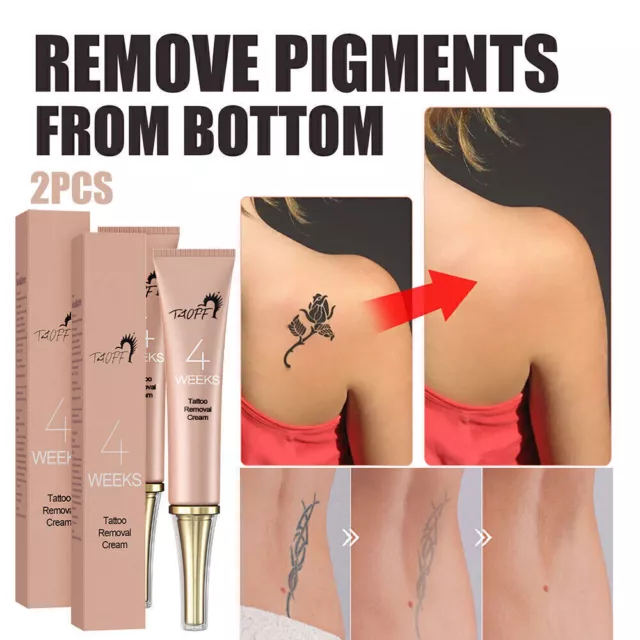 Permanent Tattoo Removal Cream Concealer Painless Tattoo Removal Cleansing  Cream 13g | Shopee Philippines