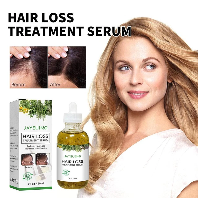 Tónico para el cabello en el cuero cabelludo esencia promover el crecimiento del cabello masaje fortalecer el cuero cabelludo reducir lo;