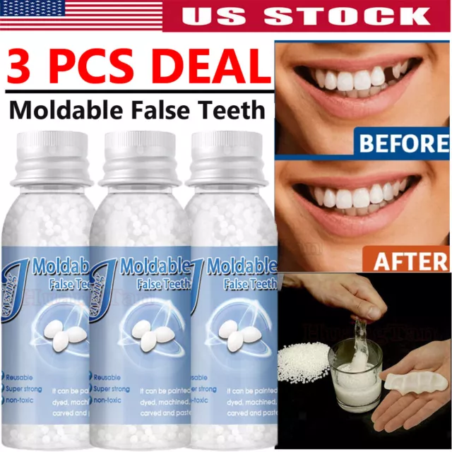 Resin False Teeth Solid Glue Temporary Tooth Repair Moldable Teeth