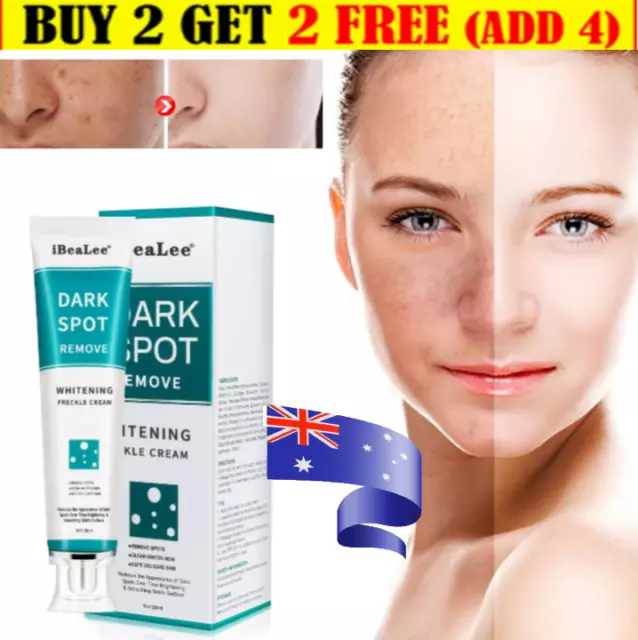 Dark Spot Remover Cream ​Freckle Cream Hyperpigmentation Melasma Skin  Whitening