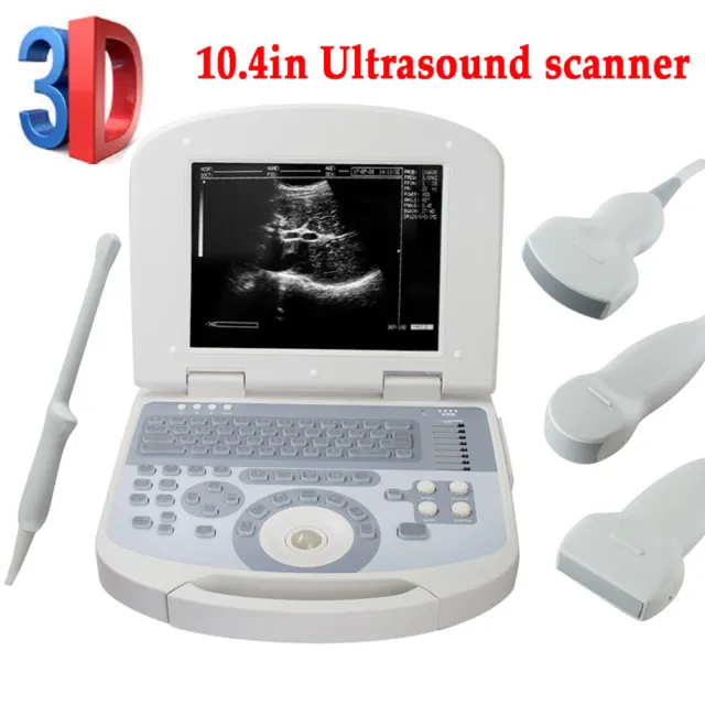 10.4in Laptop Ultrasound Scanner Convex/Linear/Micro-convex /Transvaginal Probe