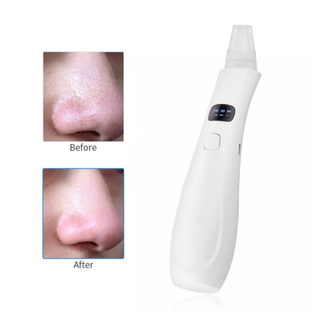 Electric Blackhead Remover Vacuum Facial Pore Acne Suction Face Cleaner Kit 3