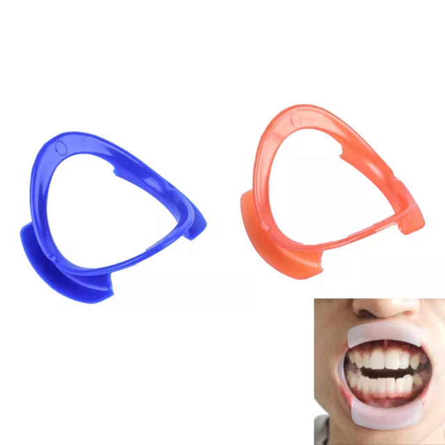 1/5X O-type Dental Teeth Whitening Cheek Retractor Lip Mouth Opener Holder.zy