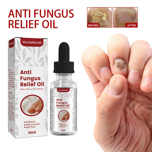 Siero di riparazione olio per unghie antimicotico cura unghie 2023 Ne ( ▲R