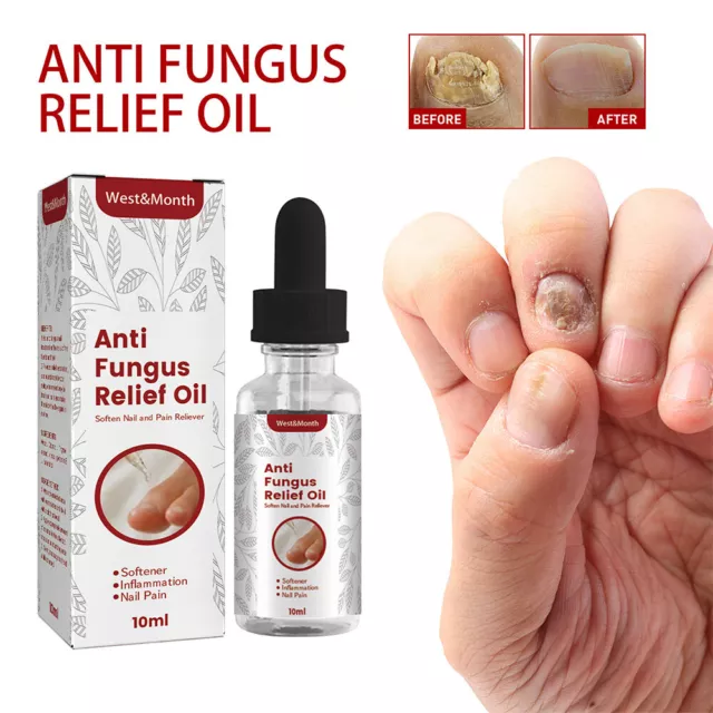 Suero de reparación de aceite de uñas antifúngico cuidado de uñas 2023 T