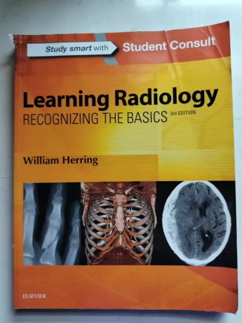 Learning Radiology - Recognizing the Basics - by William Herring 2015 3rd Nurse