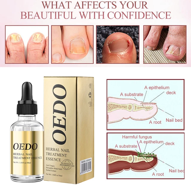 Riparazione unghie olio essenziale soluzione cura unghie smalto assistenza sanitaria E E