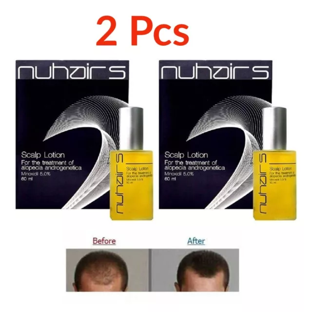 2X Nuhair 5% Hair Lotion reduce hair loss Hair Regrowth