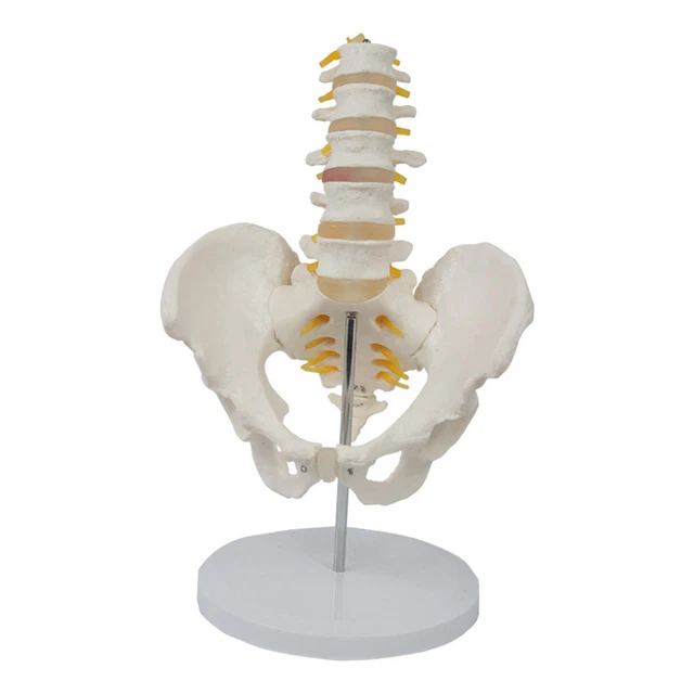 Anatomical Human Lumbar Vertebrae Degenerative Lumbar Human Model 1pcs... Anatomical Human Lumbar Vertebrae Degenerative Lumbar Human Model 1pcs...