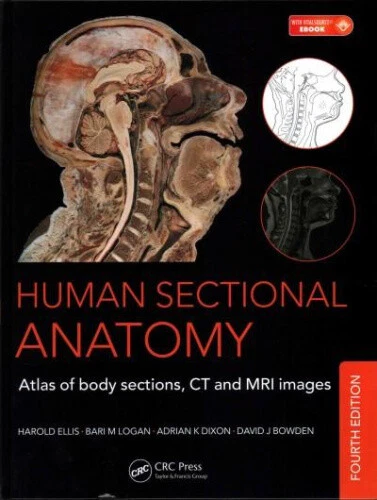 HUMAN SECTIONAL ANATOMY: Atlas of Body Sections, CT and MRI Images ...
