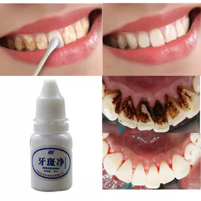 NATURAL Blanqueamiento De Dientes 10ml Higiene Oral Limpieza Dental Quitamanchas