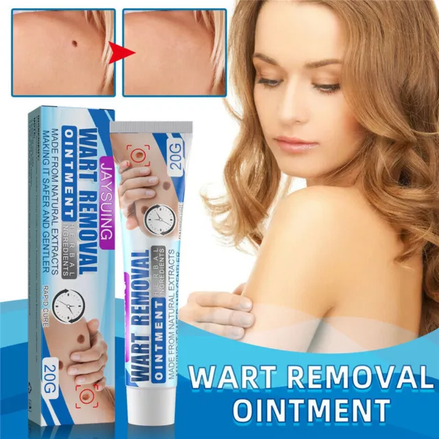 Wart Flat Antibacterial Cream Remove Wart Cream External Body Skin Care Cream`