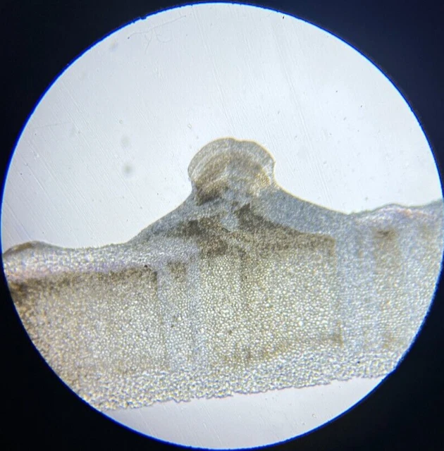 J.D. Moller Microscope Slide Sea Urchin Echinus Esculentas L. {Schaalenschliff}