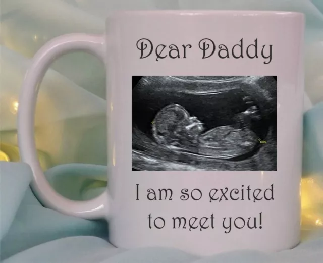 Personalised your baby scan photo mug daddy mummy nanna grandad baby shower gift