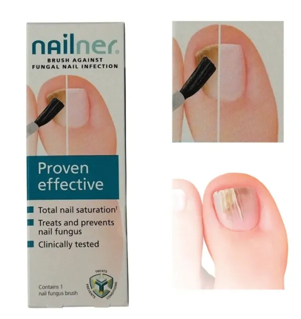 Nailner Brush Proven Effective Anti Fungal Nail Fungus Infection Treatment 5ml 2