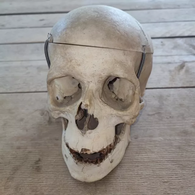crâne humain ancien,Skull, Médecine, Faculté De Médecine,Cabinet De Curiosités