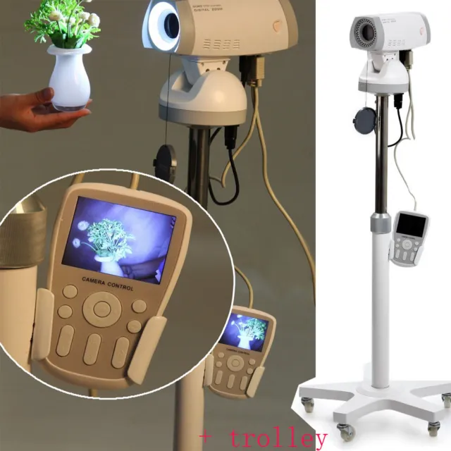 830,000 Pixels Clear Video Electronic Colposcope Camera Gynaecology+Trolley FDA