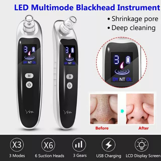 Electric Skin Care Facial Pore Cleanser Blackhead Acne Vacuum Cleaner Remover US