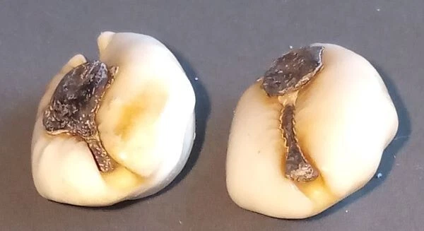 18th circa.--SOUTHEAST ASIA--ANCIENT COWRIE SHELL MONEY---set of 2 4
